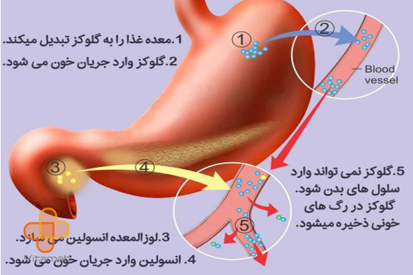 تاثیر دیابت بر دیگر اندام‌ های بدن