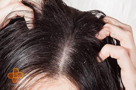 راه حل‌هایی برای جلوگیری از ریزش موها